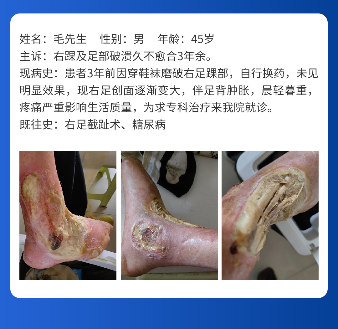 【北(běi)京市(shì)中西(xī)醫(yī)結合周圍血管疑難病會(huì)診中心】首期會(huì)診圓滿成功!(圖8) 【北(běi)京市(shì)中西(xī)醫(yī)結合周圍血管疑難病會(huì)診中心】首期會(huì)診圓滿成功!(圖8)