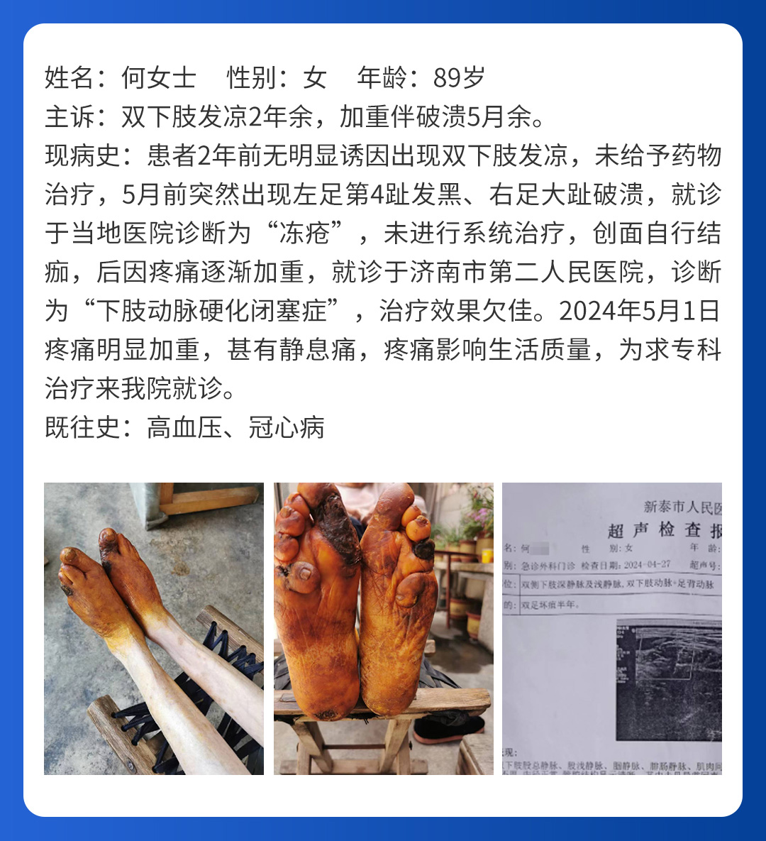 【北(běi)京市(shì)中西(xī)醫(yī)結合周圍血管疑難病會(huì)診中心】首期會(huì)診圓滿成功!(圖7) 【北(běi)京市(shì)中西(xī)醫(yī)結合周圍血管疑難病會(huì)診中心】首期會(huì)診圓滿成功!(圖7)