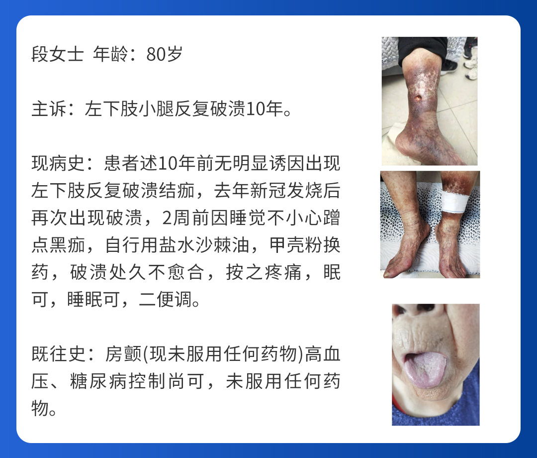 【北(běi)京市(shì)中西(xī)醫(yī)結合周圍血管疑難病會(huì)診中心】第三期會(huì)診(圖6) 【北(běi)京市(shì)中西(xī)醫(yī)結合周圍血管疑難病會(huì)診中心】第三期會(huì)診(圖6)