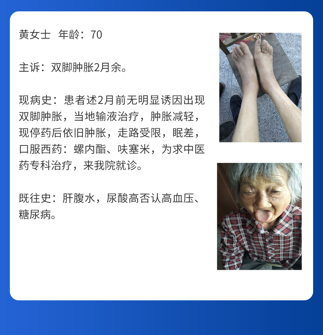 【北(běi)京市(shì)中西(xī)醫(yī)結合周圍血管疑難病會(huì)診中心】第三期會(huì)診(圖7) 【北(běi)京市(shì)中西(xī)醫(yī)結合周圍血管疑難病會(huì)診中心】第三期會(huì)診(圖7)